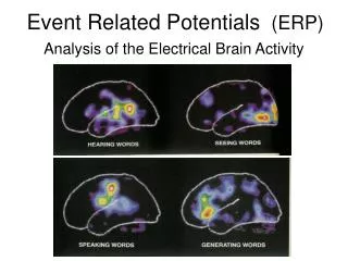 Event Related Potentials (ERP)
