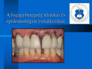 A fogágybetegség klinikai és epidemiológiai vonatkozásai