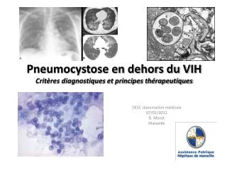 Pneumocystose en dehors du VIH Critères diagnostiques et principes thérapeutiques