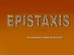 EPISTAXIS - slide 1