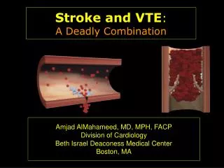 Stroke and VTE : A Deadly Combination