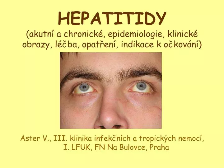hepatitidy akutn a chronick epidemiologie klinick obrazy l ba opat en indikace k o kov n