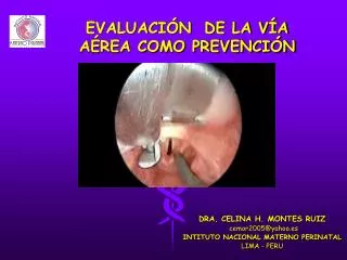 evaluaci n de la v a a rea como prevenci n