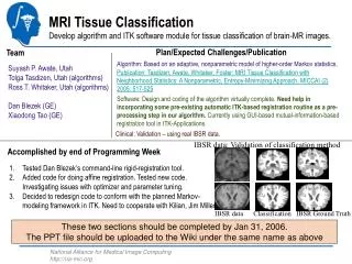 MRI Tissue Classification Develop algorithm and ITK software module for tissue classification of brain-MR images.