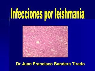 Infecciones por leishmania