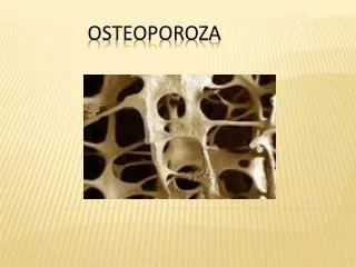 OSteoporoza