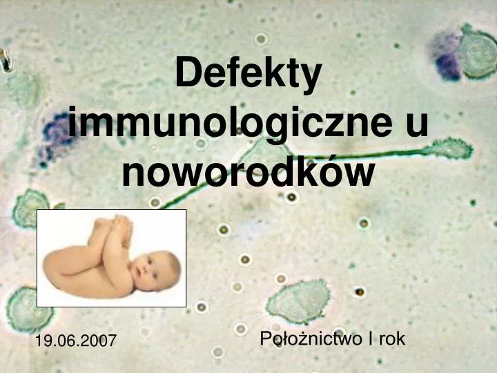 defekty immunologiczne u noworodk w