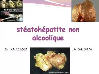 st atoh patite non alcoolique