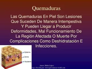 quemaduras