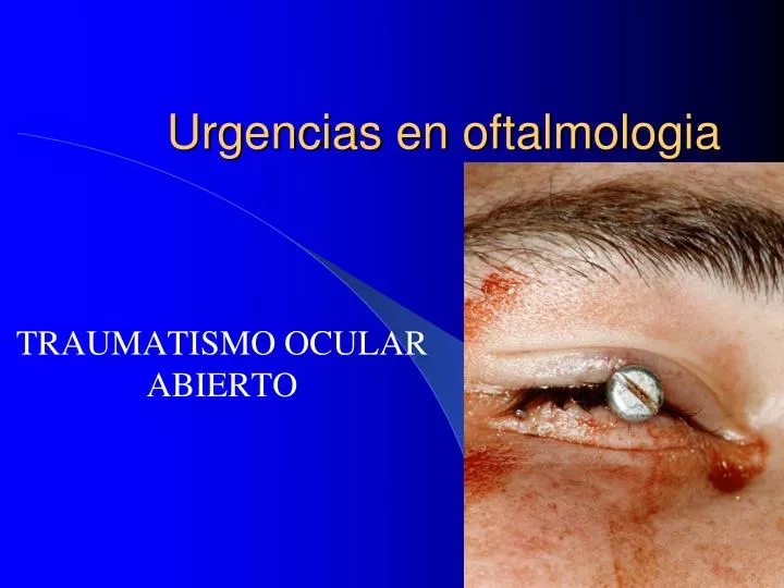 urgencias en oftalmologia
