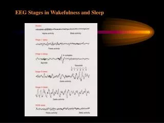 EEG Stages in Wakefulness and Sleep