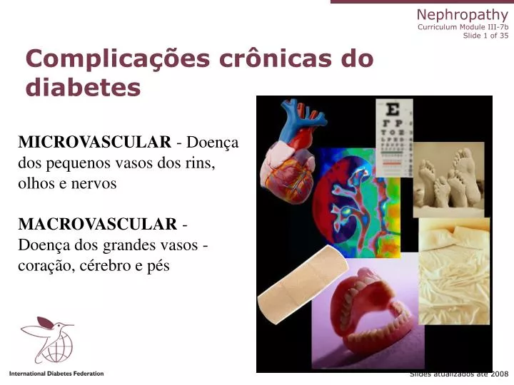 complica es cr nicas do diabetes