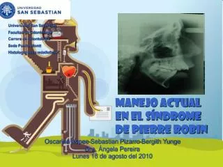 manejo actual en el s ndrome de pierre robin