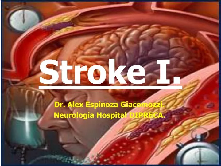 stroke i