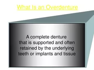 What Is an Overdenture