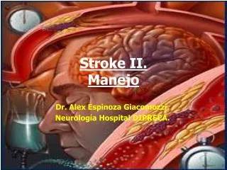 stroke ii manejo