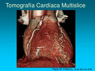 tomograf a card aca multislice