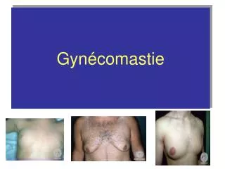gyn comastie