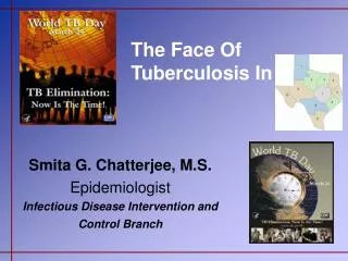 The Face Of Tuberculosis In