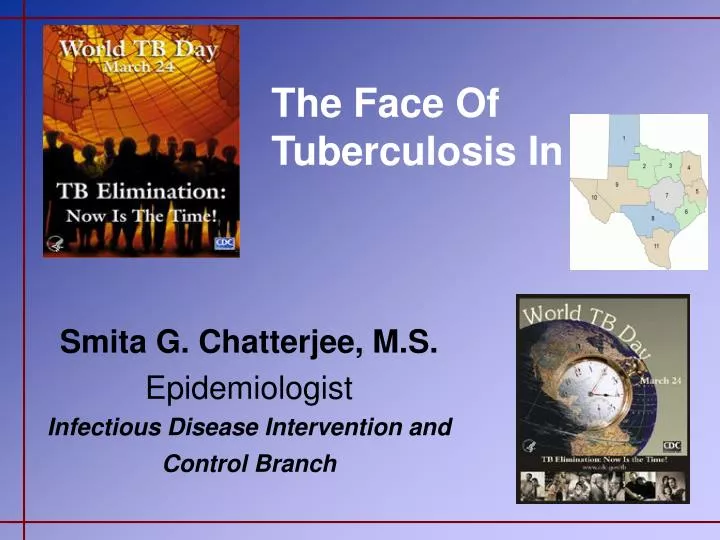 the face of tuberculosis in
