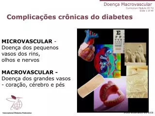 Complicações crônicas do diabetes