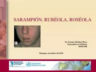sarampi n rub ola ros ola