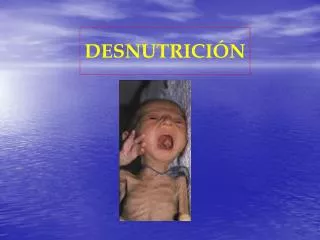 desnutrici n