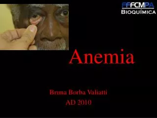 anemia