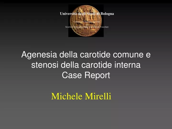 agenesia della carotide comune e stenosi della carotide interna case report
