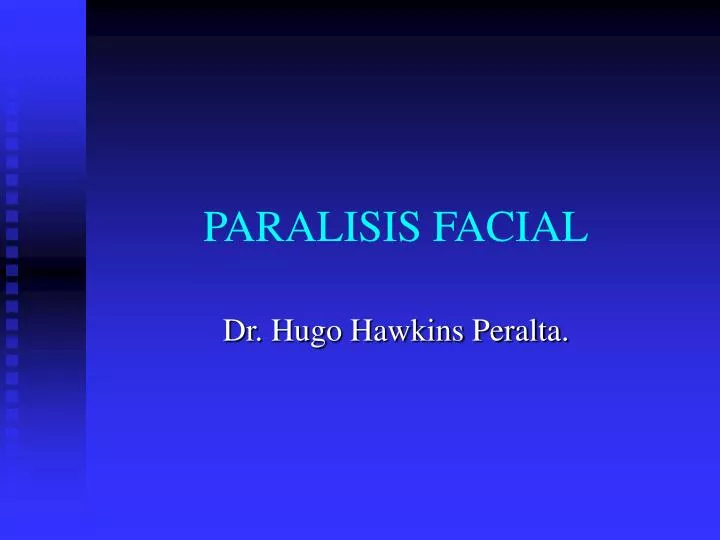 paralisis facial