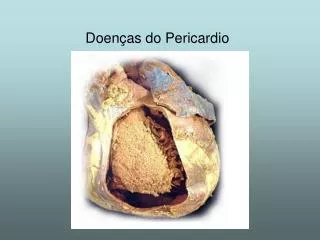 doen as do pericardio