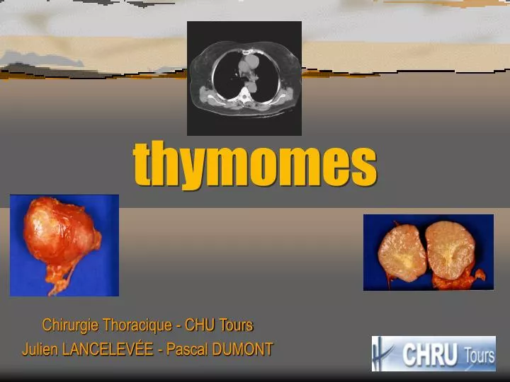 thymomes