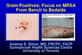 Gram-Positives: Focus on MRSA From Bench to Bedside