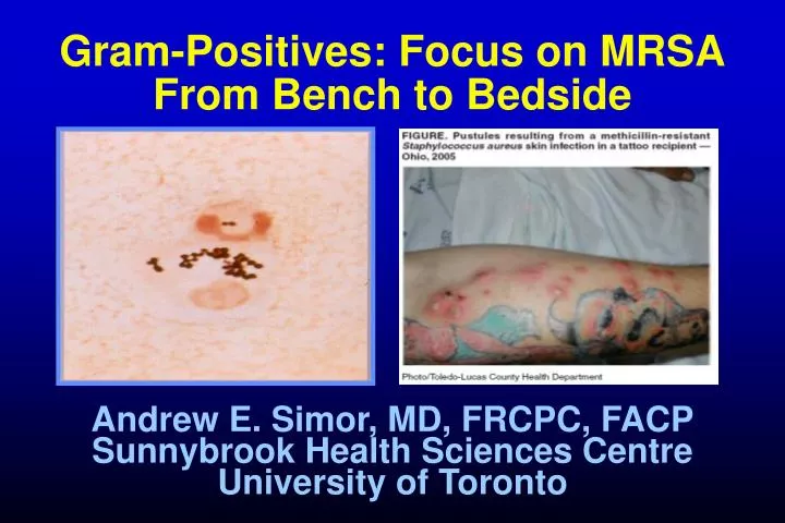 gram positives focus on mrsa from bench to bedside