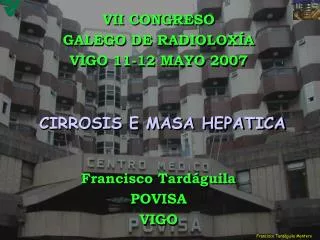 cirrosis e masa hepatica