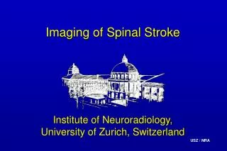 Imaging of Spinal Stroke