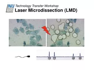 Laser Microdissection (LMD)