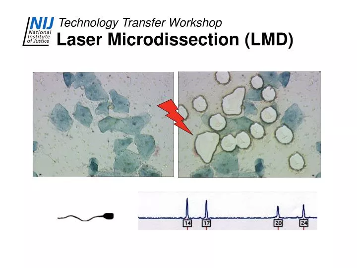 laser microdissection lmd