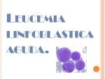 Leucemia linfoblastica aguda. - slide 1
