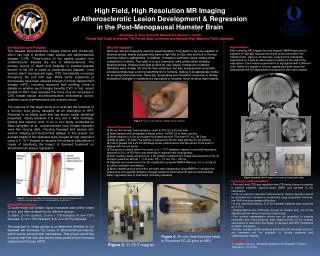 High Field, High Resolution MR Imaging of Atherosclerotic Lesion Development &amp; Regression in the Post-Menopausal Ham