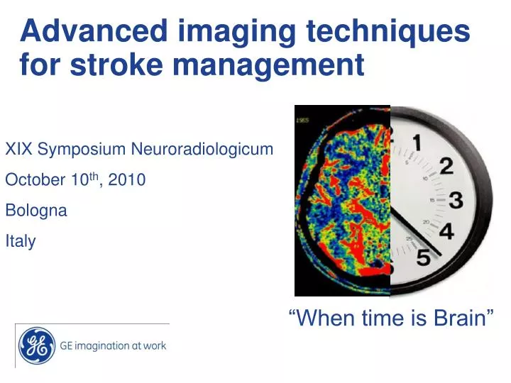 advanced imaging techniques for stroke management