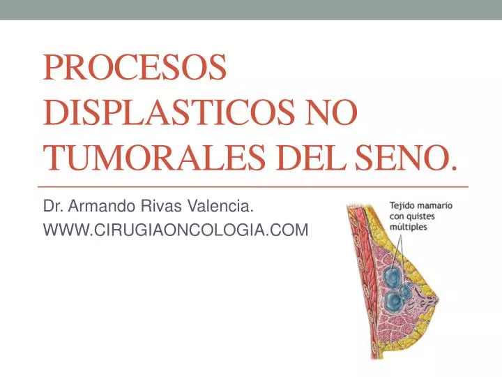 procesos displasticos no tumorales del seno