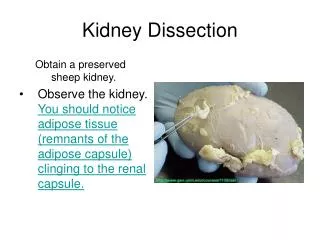 Kidney Dissection