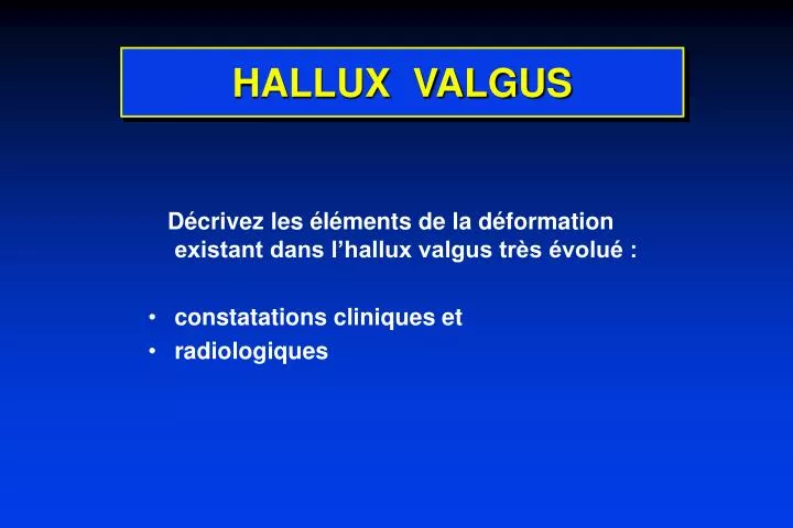 hallux valgus