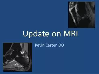 Update on MRI