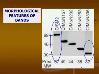 MORPHOLOGICAL FEATURES OF BANDS